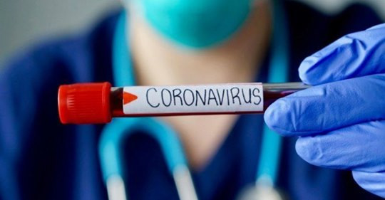 COVID19: Коронавирус судлаач зөвлөж байна