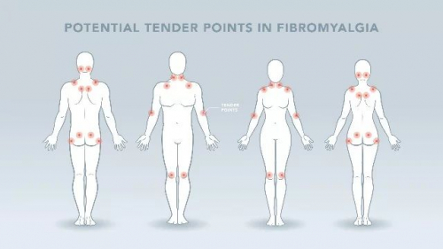 Архаг ядаргааны хам шинж болон булчин шөрмөсний эмзэглэл